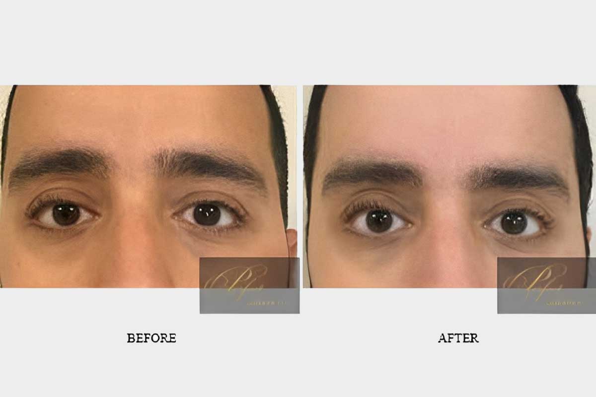 Patient's face look before and after treatments