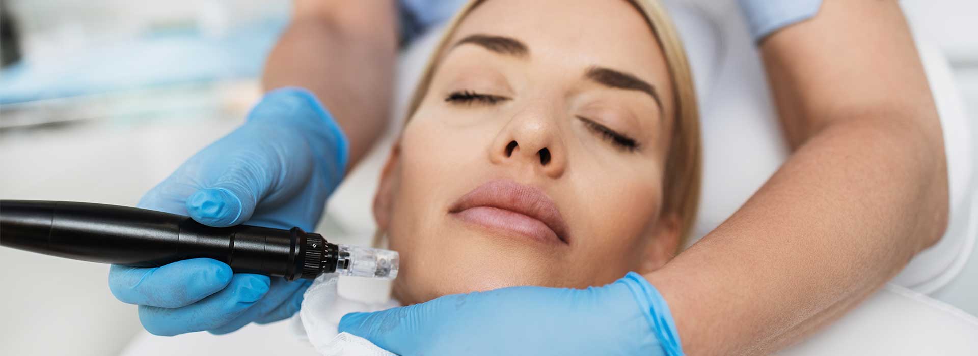 Microneedle treatments in Palm Beach area