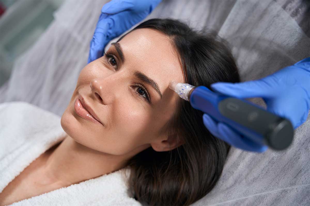 Find out about Microneedling Cost and Benefits in Palm Beach area, Florida