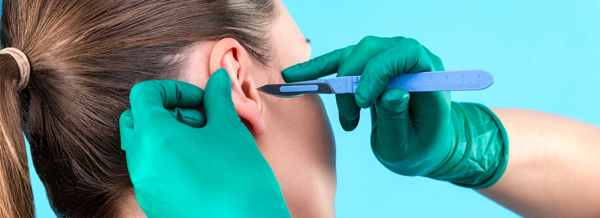 Ear lob repair at Perfect Skin MD